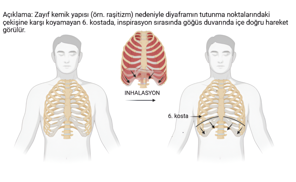 Harrison oluğu, genellikle bilateral olarak gelişen, 6. interkostal aralıkta en belirgin hale gelen bir sulkustur. Sternuma yakın bölgede en derin noktasına ulaşır ve midaksiller hatta doğru ilerledikçe düzleşir. Diyafram kasının negatif basınç etkisiyle kaburgaların içe çekilmesi sonucu oluşur.