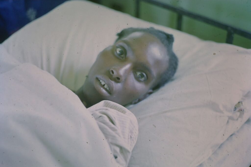 Hipokrat yüz ifadesi