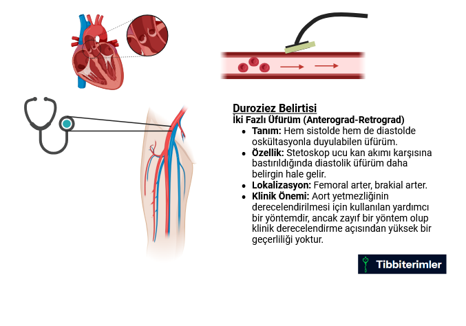 Duroziez belirtisini gösteren tıbbi diyagram. Stetoskop femoral arter üzerine yerleştirilerek, proksimale bası uygulandığında sistolik, distale bası uygulandığında diastolik üfürüm duyulmasını açıklayan görsel. Aort yetmezliği teşhisinde kullanılan fizik muayene bulgusunu gösteren şema.